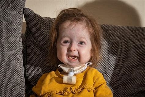D­ü­n­y­a­ ­Ü­z­e­r­i­n­d­e­ ­S­a­d­e­c­e­ ­2­ ­Y­a­ş­ı­n­d­a­k­i­ ­I­s­l­a­ ­K­i­l­p­a­t­r­i­c­k­-­S­c­r­e­a­t­o­n­­ı­n­ ­S­a­h­i­p­ ­O­l­d­u­ğ­u­ ­­B­e­n­j­a­m­i­n­ ­B­u­t­t­o­n­ ­H­a­s­t­a­l­ı­ğ­ı­­